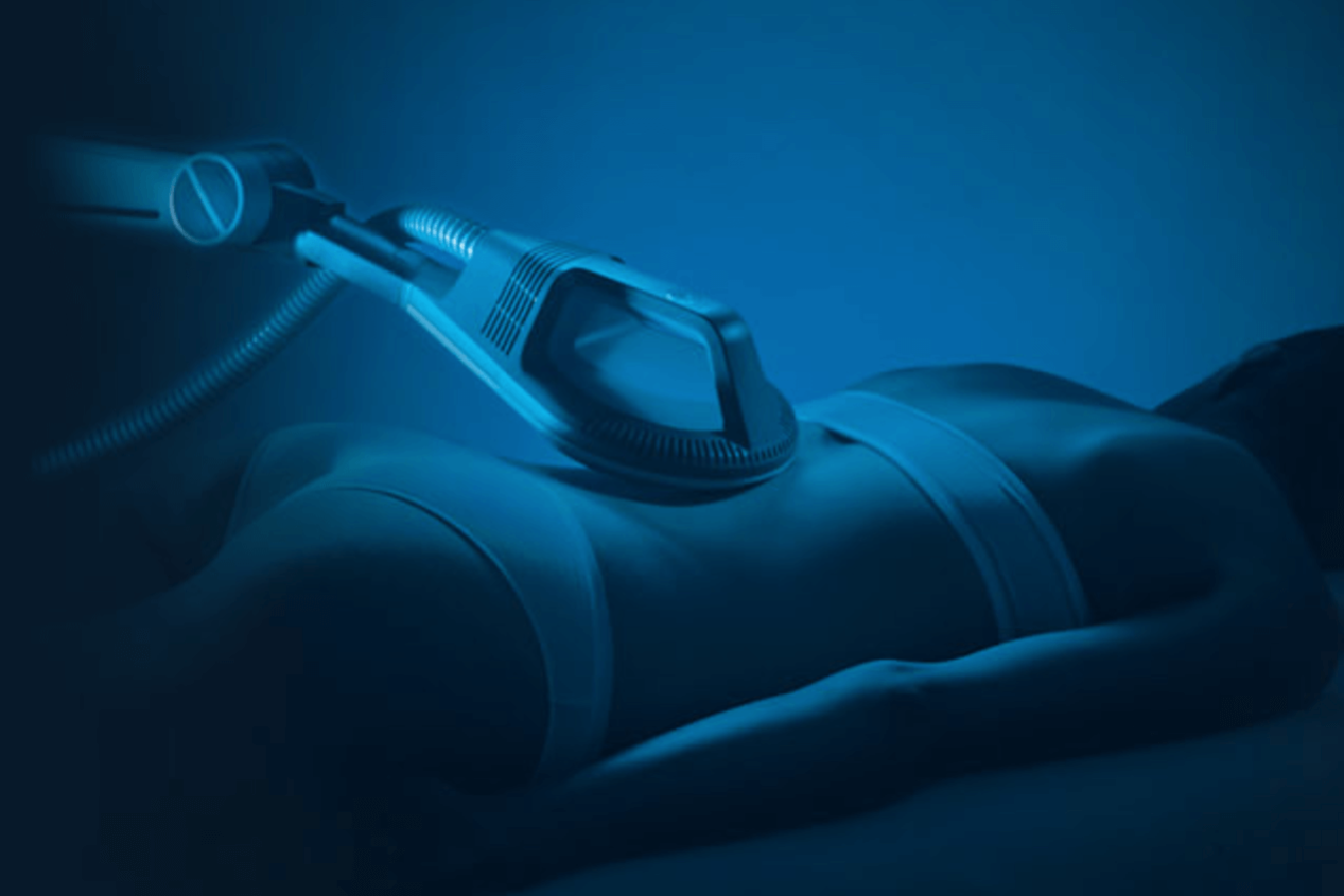 superinductive_system super inductive system gerät aus der Zukunft